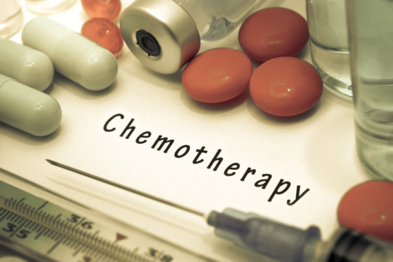 What to Expect When Undergoing Chemotherapy