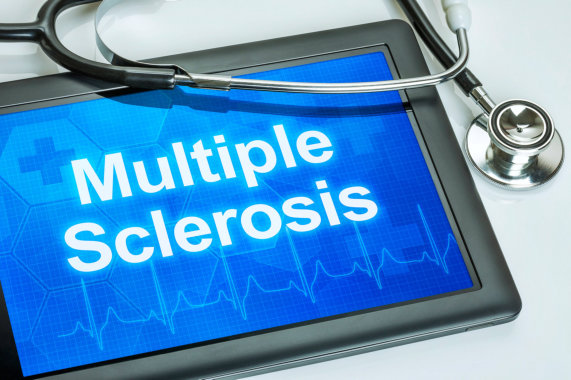 Understanding and Managing Multiple Sclerosis